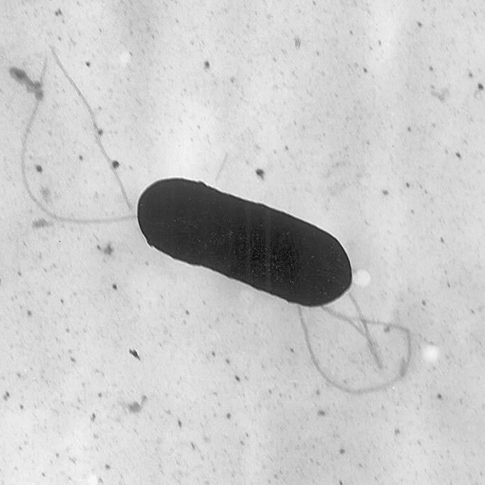 More Listeria infections reported amid outbreak linked to plant-based milk recall